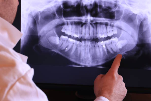 Best Emergency Dental Extractions in Del City, OK